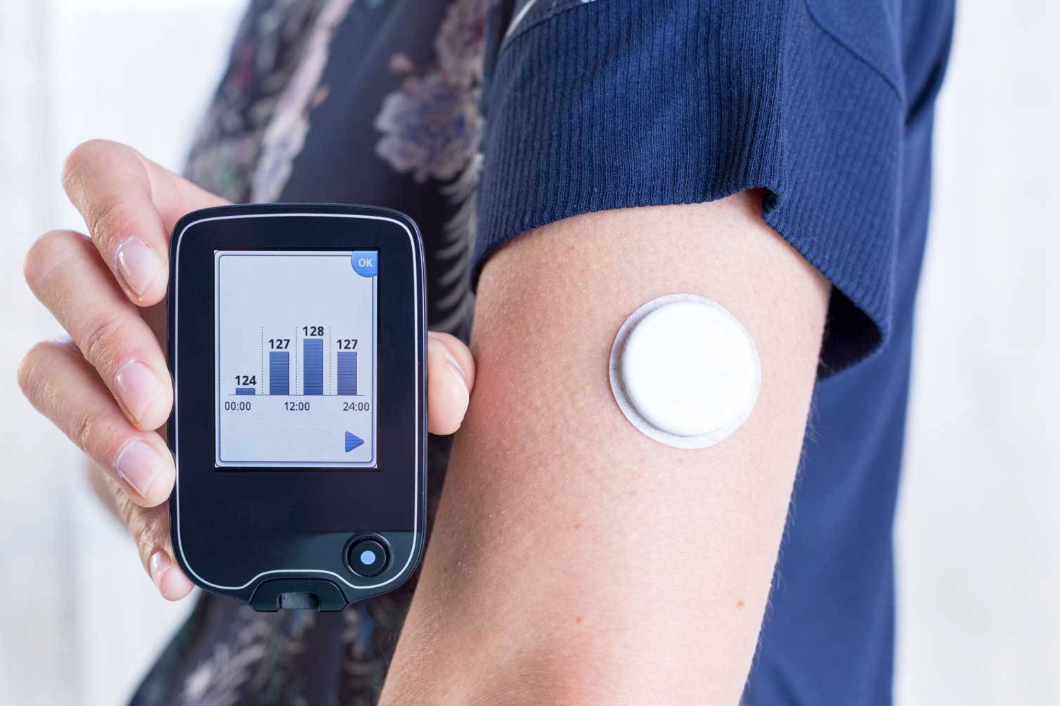 A person holds a glucose monitoring device displaying blood sugar levels, while wearing a sensor on their arm for continuous tracking.